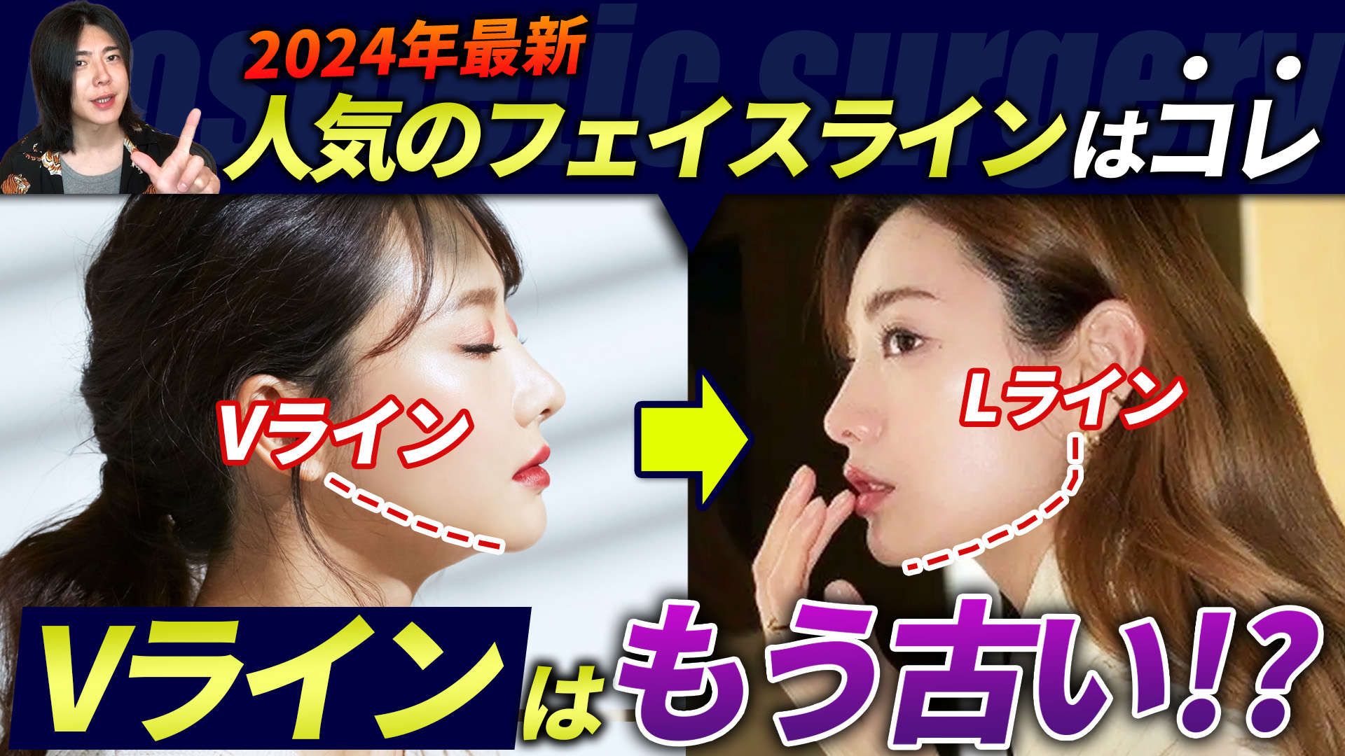 Vラインは古い？今のトレンドはLライン！流行りの輪郭を解説