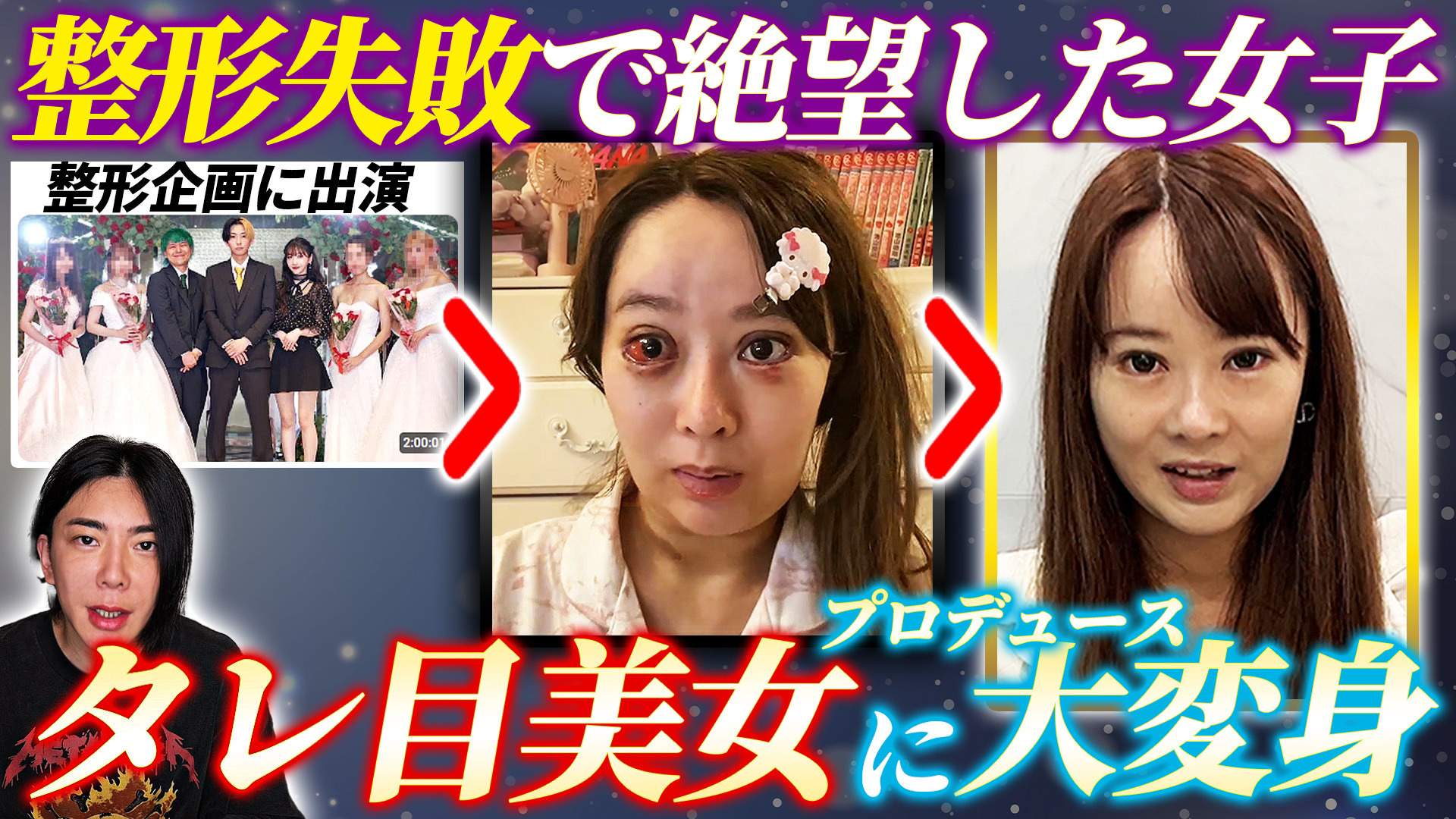 【ヒカル整形企画の女子参戦①】整形コンシェルジュが修正プロデュース【前半】